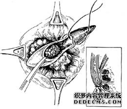 得了便血不治會(huì)有什么樣的后果